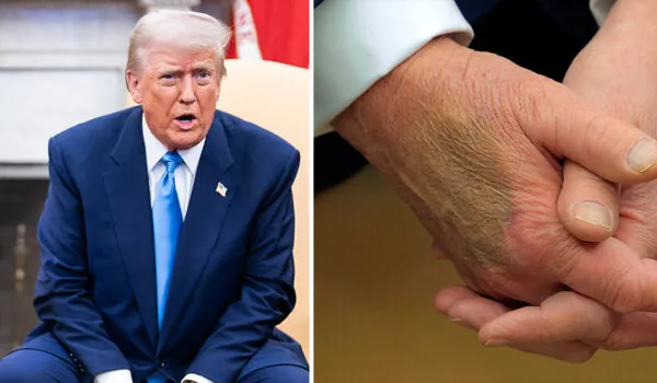 Witte Huis reageert na nare blauwe plek bij Donald Trump