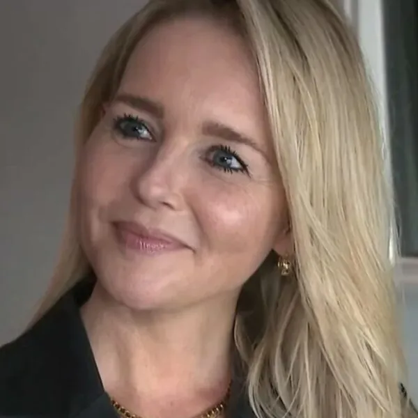 Chantal Janzen verminkt na mislukte cosmetische ingreep: ´Nooit meer doen´