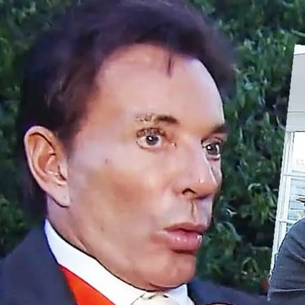 Gerard Joling haalt uit na kritiek op nieuw uiterlijk