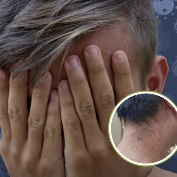 Nieuwe virusuitbraak nog maar één vliegreis verwijderd: Patiënten delen horrorfoto’s van de symptomen
