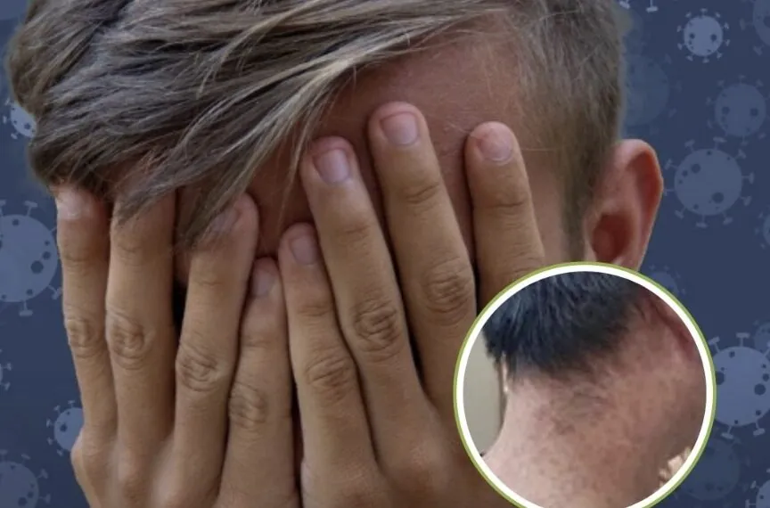 Nieuwe virusuitbraak nog maar één vliegreis verwijderd: Patiënten delen horrorfoto’s van de symptomen