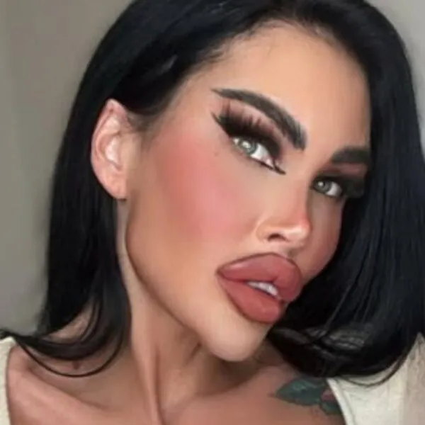 Ze heeft bijna 200.000 euro uitgegeven aan plastische chirurgie omdat ze haar uiterlijk niet leuk vond