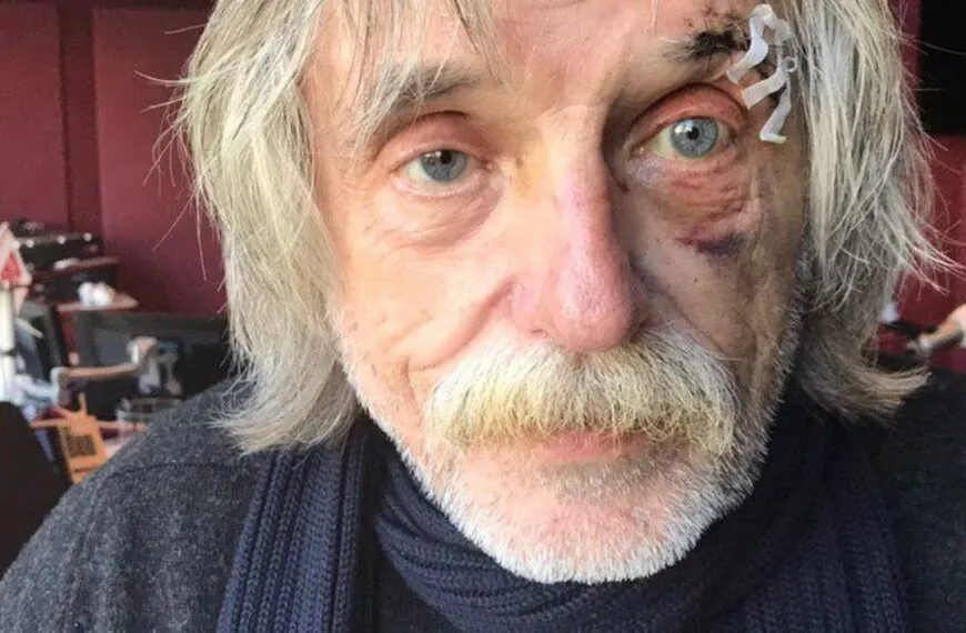 Johan Derksen blijkt ernstige aandoening te hebben