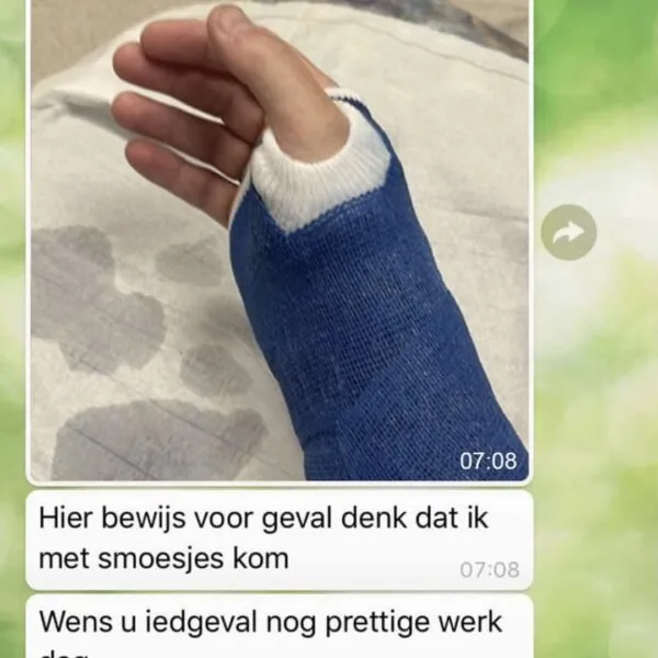 Uitzendkracht meldt zichzelf ziek omdat zijn arm in het gips zit, maar hij had misschien toch beter een andere foto mee kunnen sturen (2 screens)