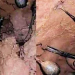 Ik was aan het graven in het bos toen ik een nest tegenkwam. Mijn vrienden zeiden dat ik onmiddellijk weg moest rennen