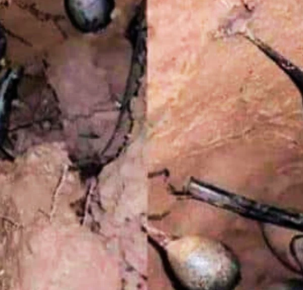 Ik was aan het graven in het bos toen ik een nest tegenkwam. Mijn vrienden zeiden dat ik onmiddellijk weg moest rennen