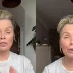 Bovenste helft van het gezicht van Bridget Maasland beweegt niet meer na botoxbehandeling