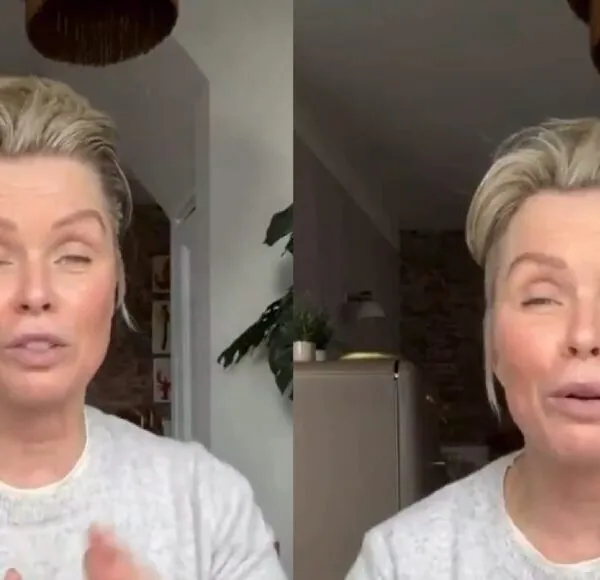 Bovenste helft van het gezicht van Bridget Maasland beweegt niet meer na botoxbehandeling