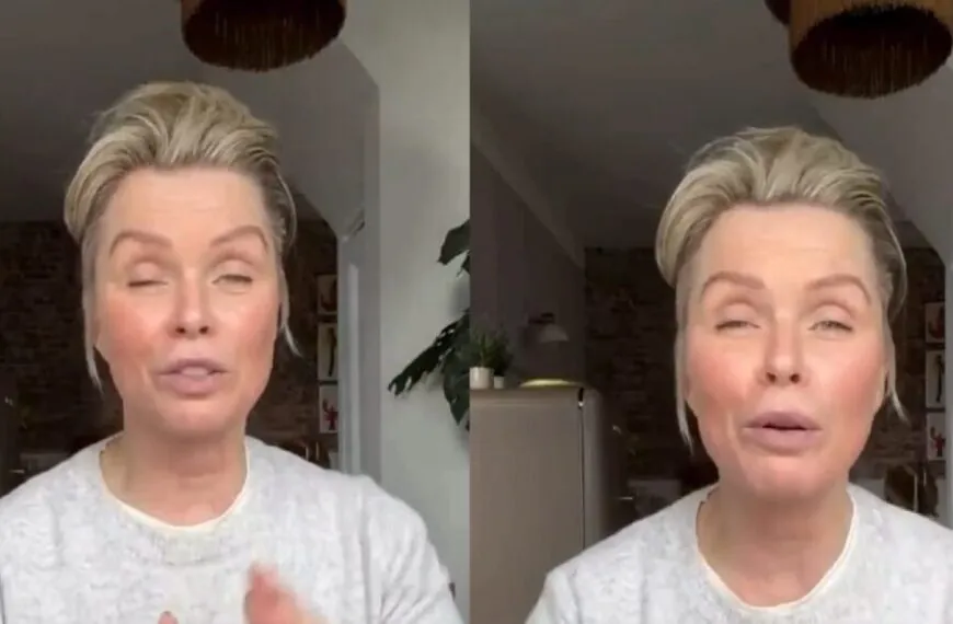 Bovenste helft van het gezicht van Bridget Maasland beweegt niet meer na botoxbehandeling